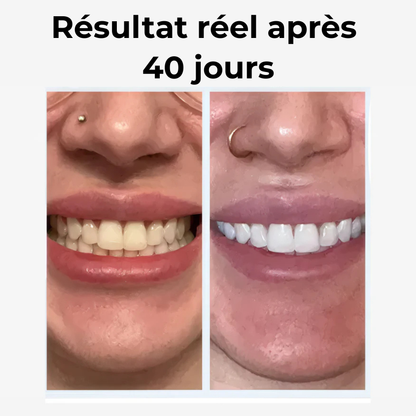 Brosse a dent - Clefio Pulse360